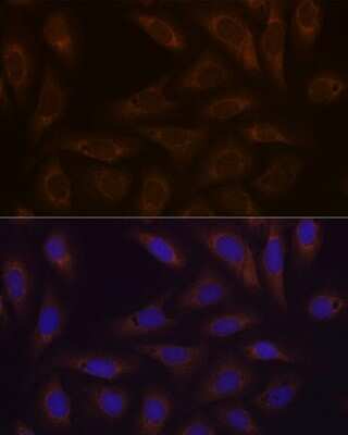 Immunocytochemistry/ Immunofluorescence: Dcp1a Antibody (7Q8Q6) [NBP3-16644]