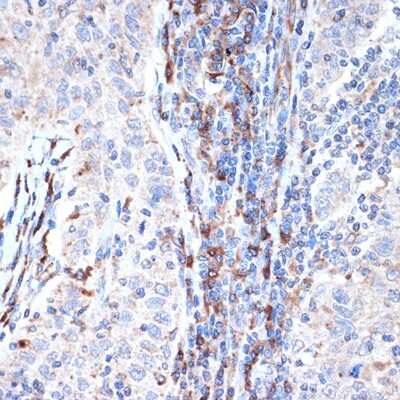 Immunohistochemistry-Paraffin: Dcp1a Antibody (7Q8Q6) [NBP3-16644]