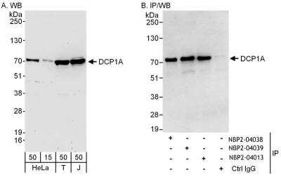 Immunoprecipitation: Dcp1a Antibody [NBP2-04013]