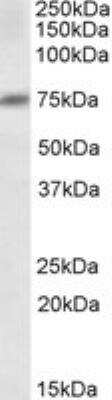 Western Blot: Dcp1a Antibody [NB100-2830]