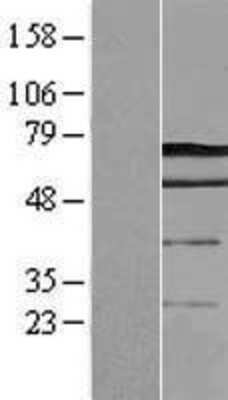 Western Blot: Dcp1a Overexpression Lysate [NBL1-09745]