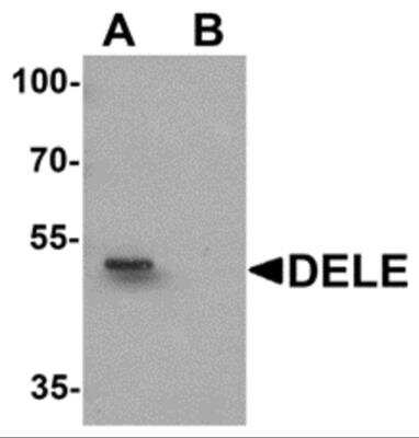 Western Blot: Death Ligand Signal Enhancer AntibodyBSA Free [NBP2-81912]