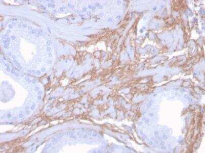 Immunohistochemistry-Paraffin: Decorin Antibody (DCN/3523) - Azide and BSA Free [NBP2-79908]