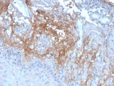 Immunohistochemistry-Paraffin: Decorin Antibody (DCN/3523) - Azide and BSA Free [NBP2-79908]