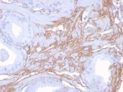 Immunohistochemistry-Paraffin: Decorin Antibody (DCN/3523) [NBP2-79774]