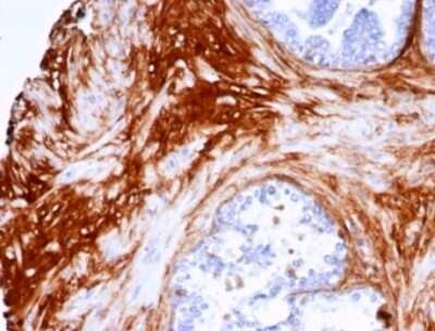 Immunohistochemistry-Paraffin: Decorin Antibody (DCN/7031R) [NBP3-13862]