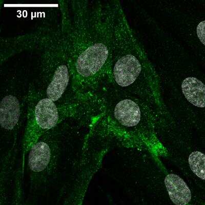 Immunocytochemistry/ Immunofluorescence: Decorin Antibody [NBP1-57923]