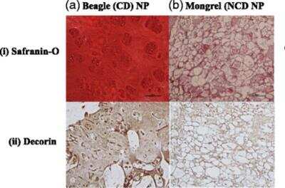 Immunohistochemistry: Decorin Antibody [NBP1-57923]