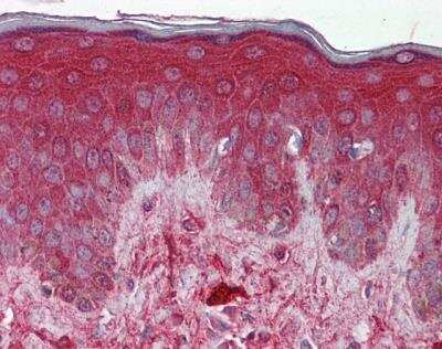 Immunohistochemistry-Paraffin: Decorin Antibody [NBP1-57923]