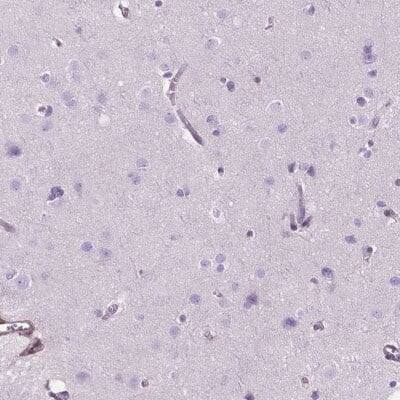 Immunohistochemistry-Paraffin: Decorin Antibody [NBP2-56346]