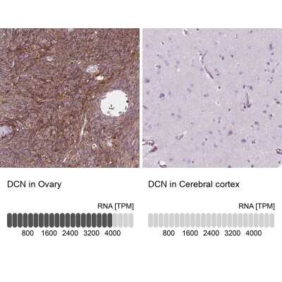 Immunohistochemistry-Paraffin: Decorin Antibody [NBP2-56346]