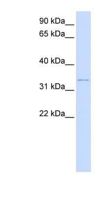 Western Blot: Decorin Antibody [NBP1-57923]