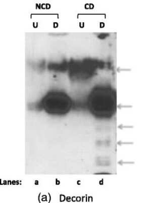 Western Blot: Decorin Antibody [NBP1-57923]