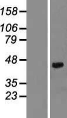 Western Blot: Decorin Overexpression Lysate [NBL1-09744]