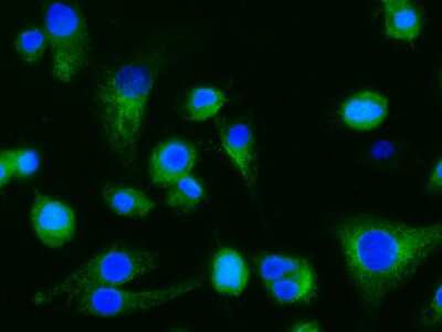 Immunocytochemistry/ Immunofluorescence: Dectin-1/CLEC7A Antibody (010) [NBP2-90491]