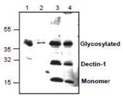 Western Blot: Dectin-1/CLEC7A Antibody [NBP1-45514]