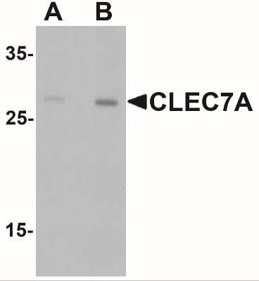 Western Blot: Dectin-1/CLEC7A AntibodyBSA Free [NBP2-41170]