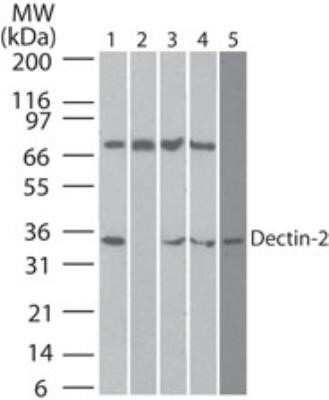 Western Blot: Dectin-2/CLEC6A Antibody (3D1)Azide and BSA Free [NBP2-36486]