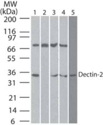 Western Blot: Dectin-2/CLEC6A Antibody (3D1)BSA Free [NBP2-27159]