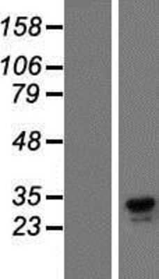 Western Blot: Dectin-1/CLEC7A Overexpression Lysate [NBP2-04760]