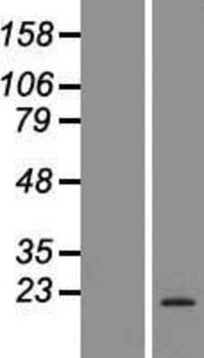 Western Blot: Dectin-1/CLEC7A Overexpression Lysate [NBP2-04761]