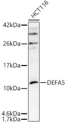 Western Blot: Defensin alpha 5 AntibodyAzide and BSA Free [NBP3-03835]