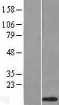 Western Blot: alpha-Defensin 1 Overexpression Lysate [NBL1-09818]