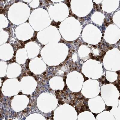 Immunohistochemistry-Paraffin: Defensin alpha 4 Antibody [NBP2-13910]