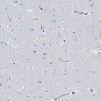 Immunohistochemistry-Paraffin: Defensin alpha 4 Antibody [NBP2-13910]