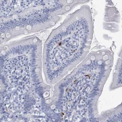 Immunohistochemistry-Paraffin: Defensin alpha 4 Antibody [NBP2-13910]