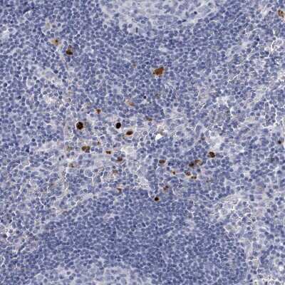 Immunohistochemistry-Paraffin: Defensin alpha 4 Antibody [NBP2-13910]