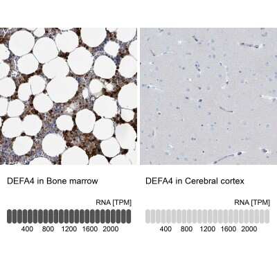Immunohistochemistry-Paraffin: Defensin alpha 4 Antibody [NBP2-13910]