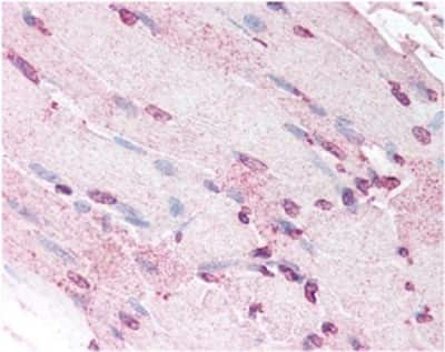 Immunohistochemistry: Defensin alpha 5 Antibody (8C8) [NB110-60002]