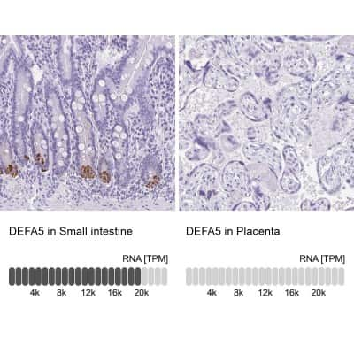 Immunohistochemistry-Paraffin: Defensin alpha 5 Antibody [NBP1-84282]