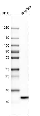 Western Blot: Defensin alpha 5 Antibody [NBP1-84282]