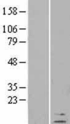 Western Blot: Defensin beta 1 Overexpression Lysate [NBL1-09822]