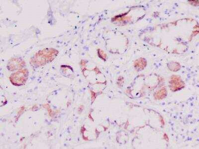 Immunohistochemistry-Paraffin: Defensin beta 2 Antibody [NBP3-11287]