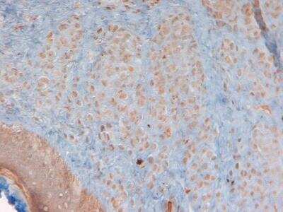 Immunohistochemistry-Paraffin: beta-Defensin 3 Antibody - BSA Free [NB200-117]