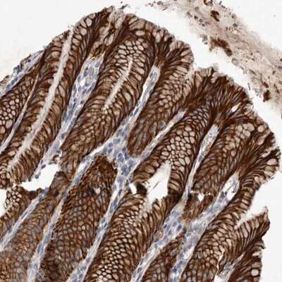 Immunohistochemistry-Paraffin: Dehydrodolichyl Diphosphate Synthase Antibody [NBP1-84975]