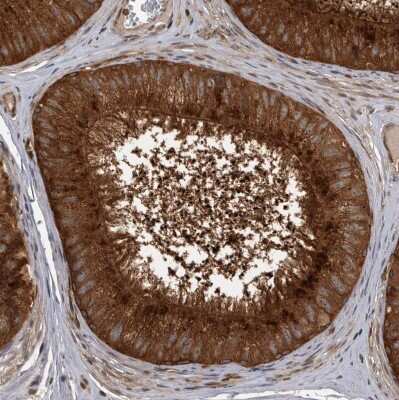 Immunohistochemistry-Paraffin: Dehydrodolichyl Diphosphate Synthase Antibody [NBP1-87964]