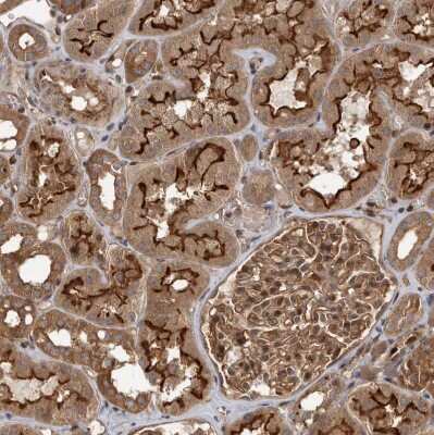 Immunohistochemistry-Paraffin: Dehydrodolichyl Diphosphate Synthase Antibody [NBP1-87964]