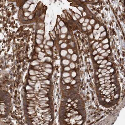 Immunohistochemistry-Paraffin: Dehydrodolichyl Diphosphate Synthase Antibody [NBP1-87964]