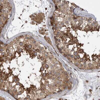 Immunohistochemistry-Paraffin: Dehydrodolichyl Diphosphate Synthase Antibody [NBP1-87964]