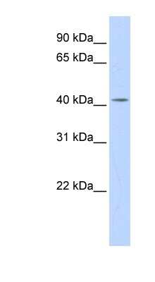 Western Blot: Dehydrodolichyl Diphosphate Synthase Antibody [NBP1-55231]