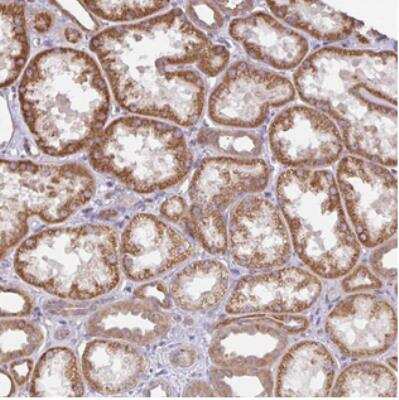 Immunohistochemistry-Paraffin: Deleted In Lymphocytic Leukemia, 7 Antibody [NBP2-30666]