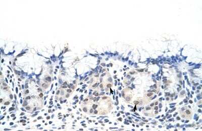 Immunohistochemistry-Paraffin: Deleted in azoospermia 4 Antibody [NBP1-57481]