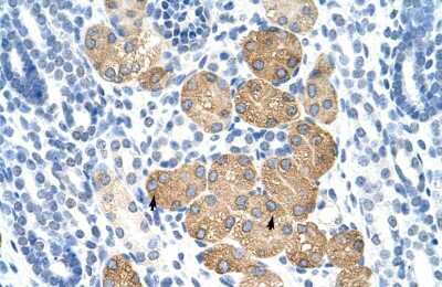 Immunohistochemistry-Paraffin: Deleted in azoospermia 4 Antibody [NBP1-57481]