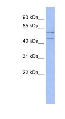 Western Blot: Deleted in azoospermia 4 Antibody [NBP1-57480]