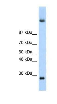 Western Blot: Deleted in azoospermia 4 Antibody [NBP1-57481]