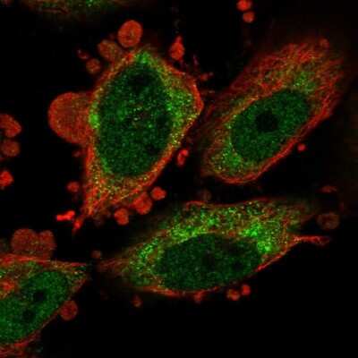 Immunocytochemistry/ Immunofluorescence: Delta 1 Tubulin Antibody [NBP1-87390]